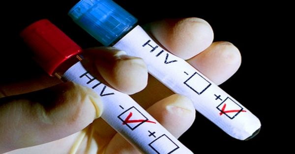 【気付かんかも】これは危険…意外と普通すぎるHIV感染後の症状