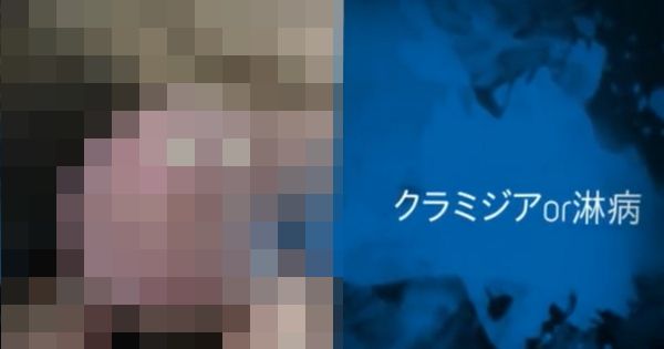 【今すぐチェック】ムスコがこんなことになってたら性病かも・・